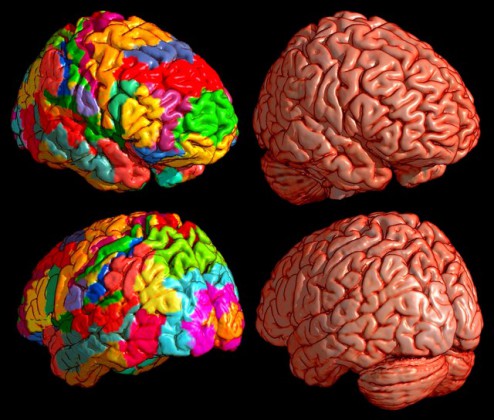 Сколько различий между картинками brain