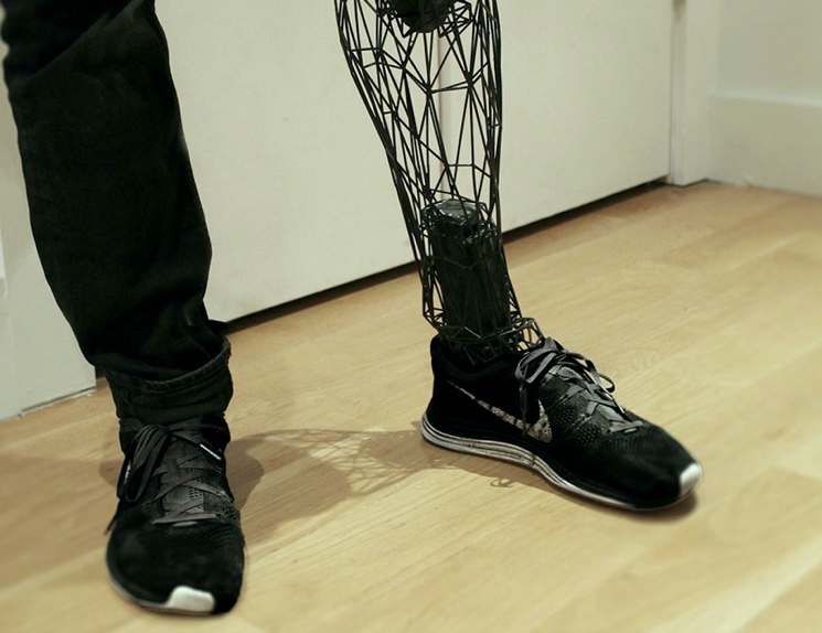 Титановый протез ноги на 3D принтере